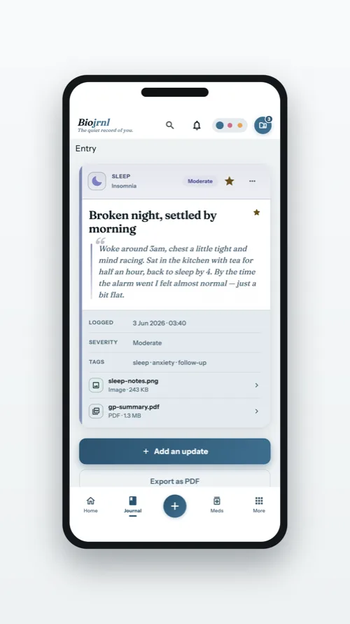 A single entry with severity, tags and attachments